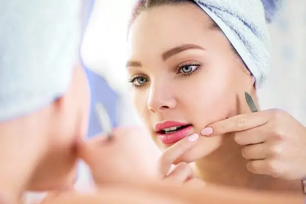 'Lấp đầy' sẹo rỗ lâu năm không khó như bạn tưởng
