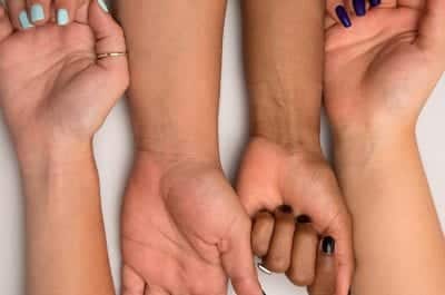 Xác định sắc tố da dựa vào tĩnh mạch ở cổ tay